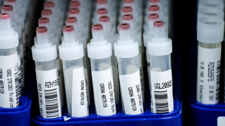 Coronavirus News: RKI reports 10.485 Corona infections and 689 deaths