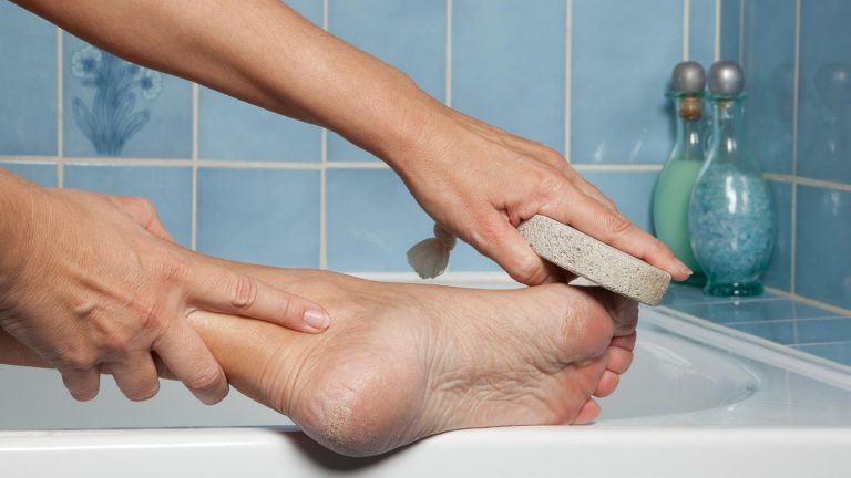 Remove cornea: tips for beautiful feet